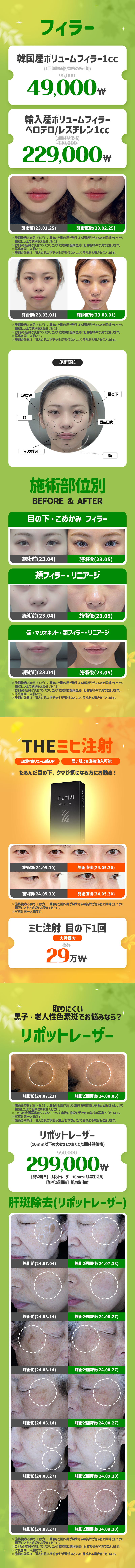 チェジュ店 イベント画像3